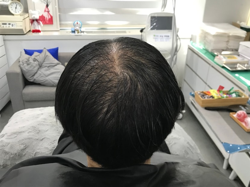 시술 전 젖은 머리 사진 1 