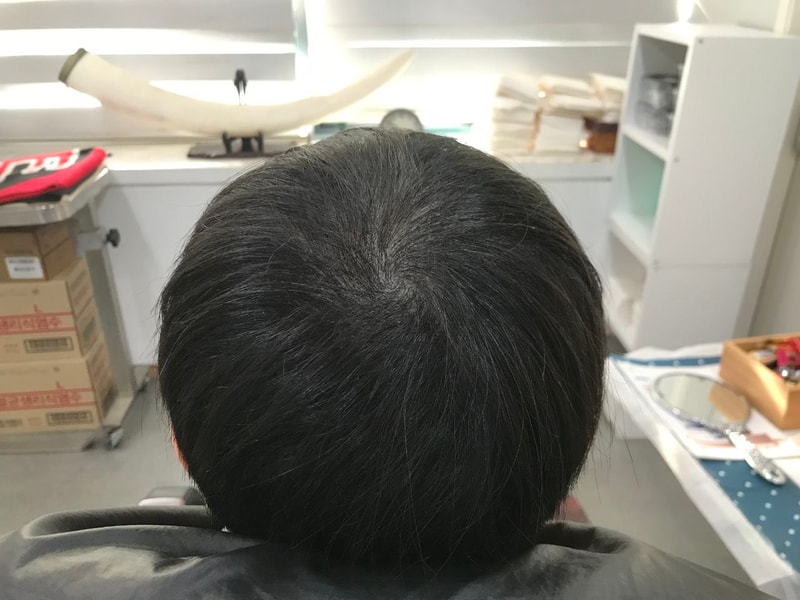 延世ミダイン 1次リタッチレビュー