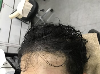 후
