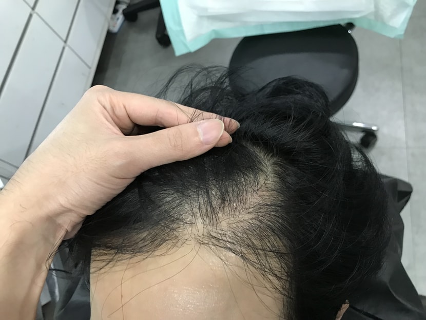 전