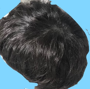 리터치 3주뒤 적당한조명