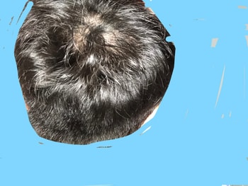 리터치전(밝은조명)