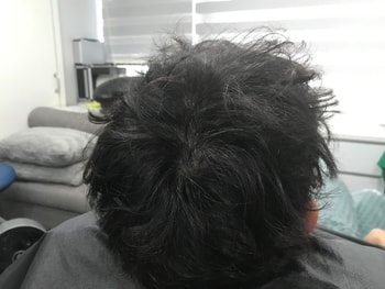 시술전 병원측제공