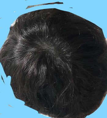 리터치 3주뒤 적당한조명