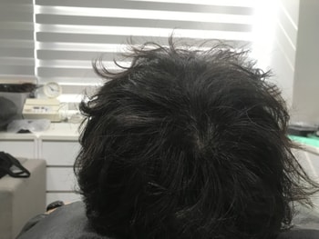 시술전 병원측제공