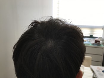 시술 2년째 병원에서 제공해준 사진입니다.