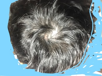 리터치전(밝은조명)