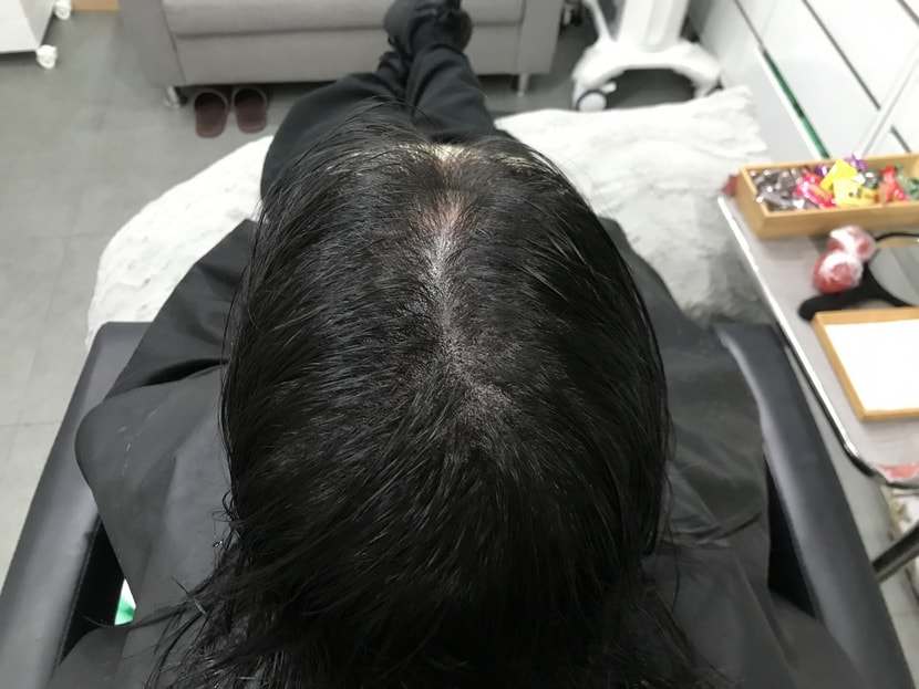 더 비싸긴 하지만 미다인 시그니쳐 기술로 받길 잘 한듯!