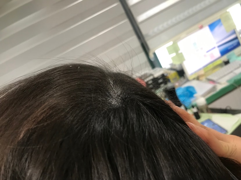 약간의 각질