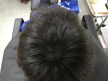 수술후