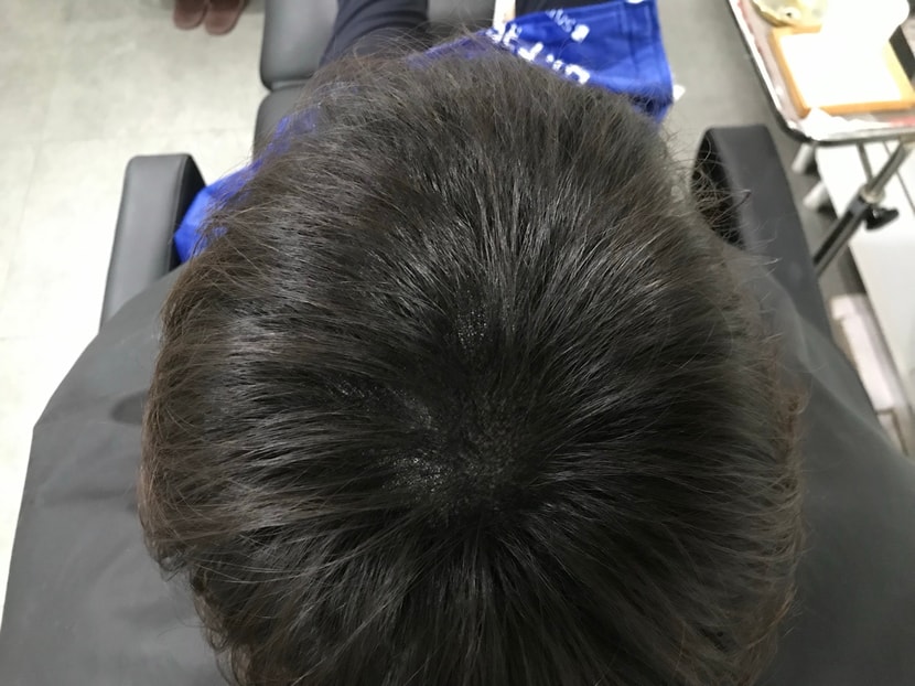 수술후
