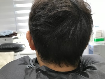 리터치전