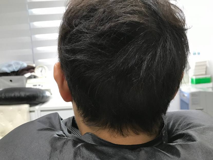 리터치전