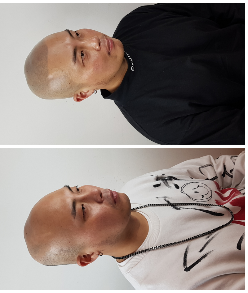 6주에걸려완성한 두피문신