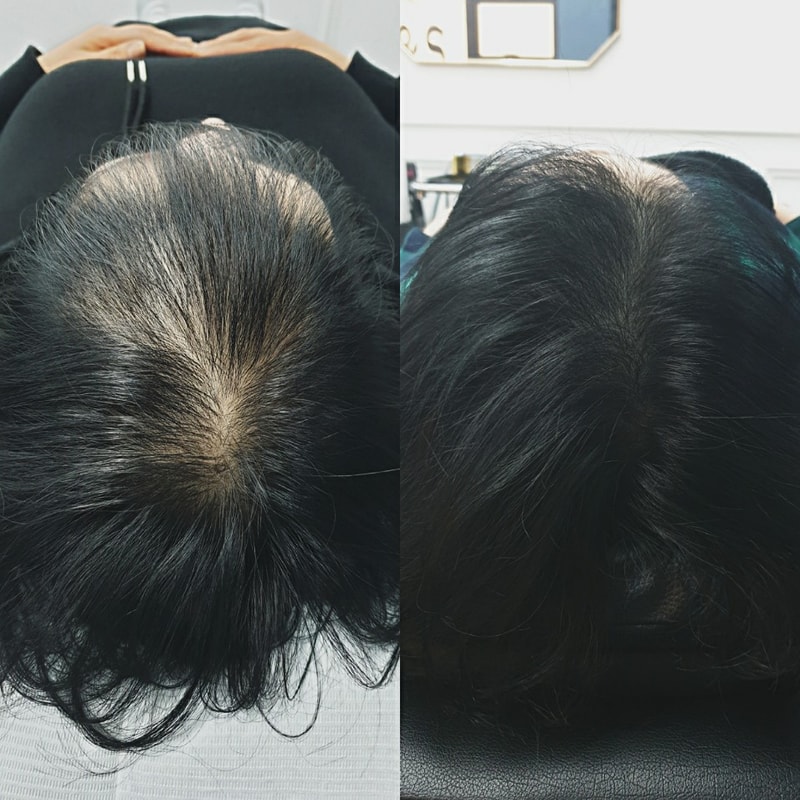 头皮纹身后期