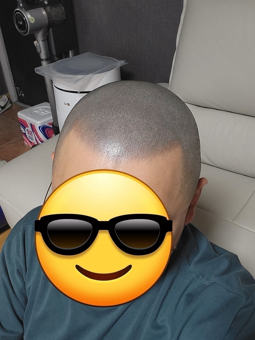 8차 마무리하고  4일후 