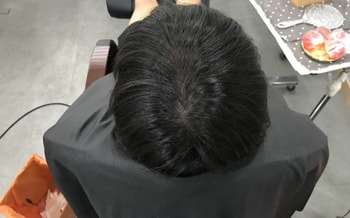 시술전