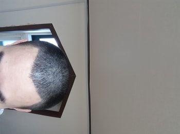 4일후머리감은후 밝은곳에서