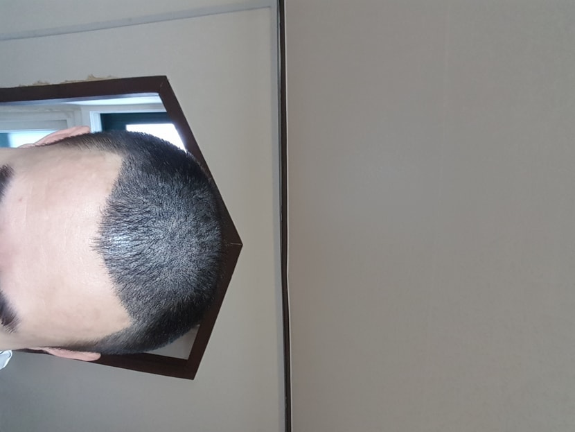 4일후머리감은후 밝은곳에서