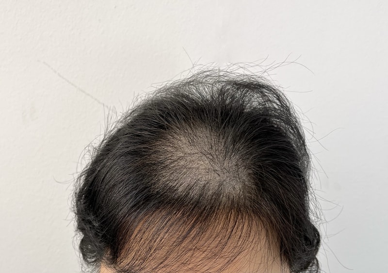 頭皮のタトゥー、2回目満足ですね