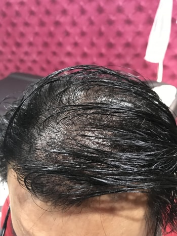 2차 직후 앞쪽