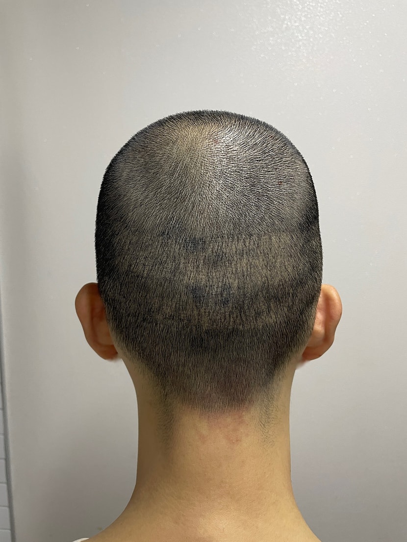 2차 후