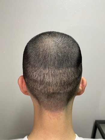1차 후