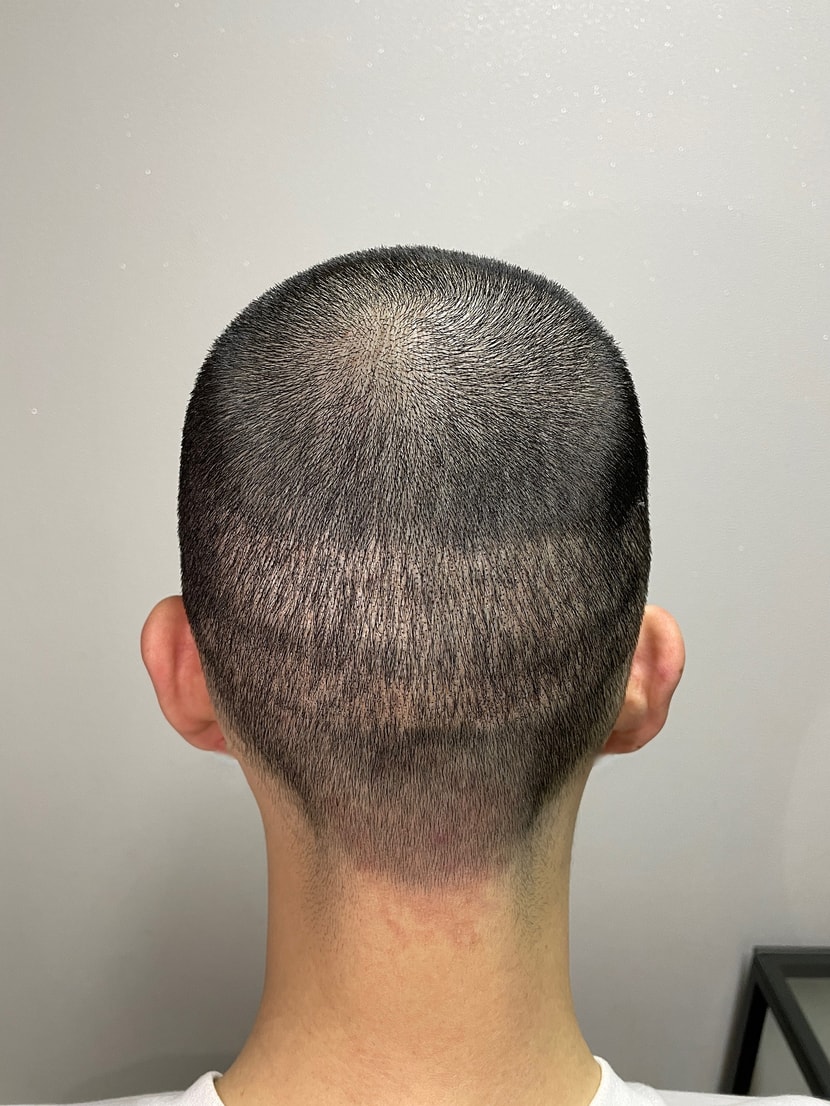 1차 후