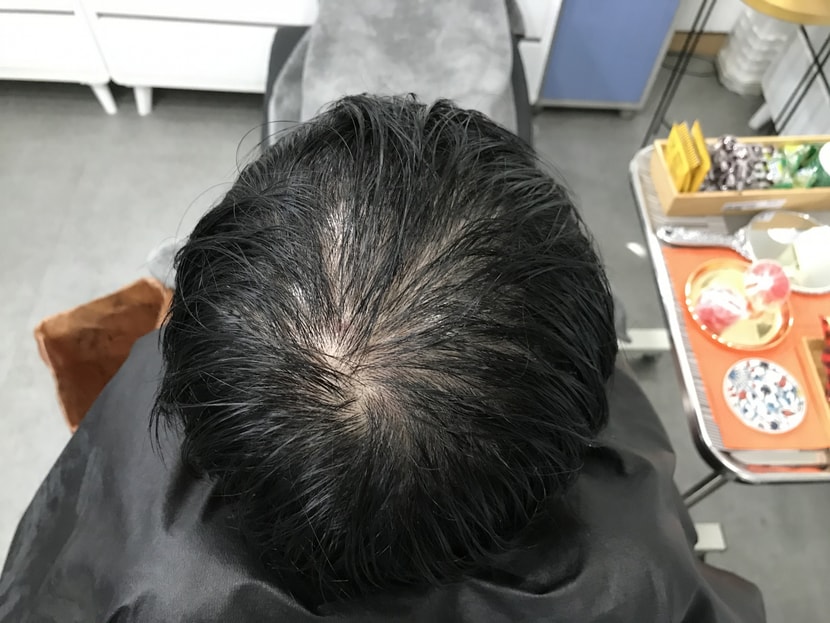 시술전 물묻힌사진