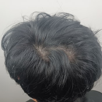전후