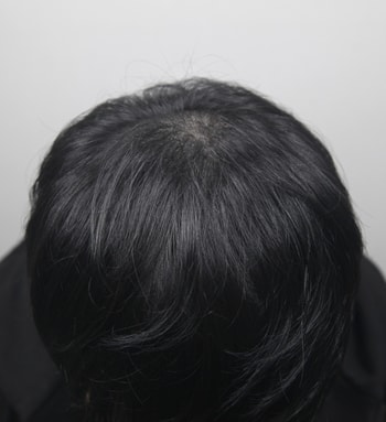 후