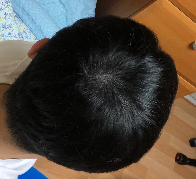 일주일 후 집에서 촬영한 사진