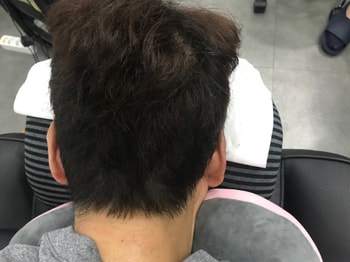 2차 리터치후