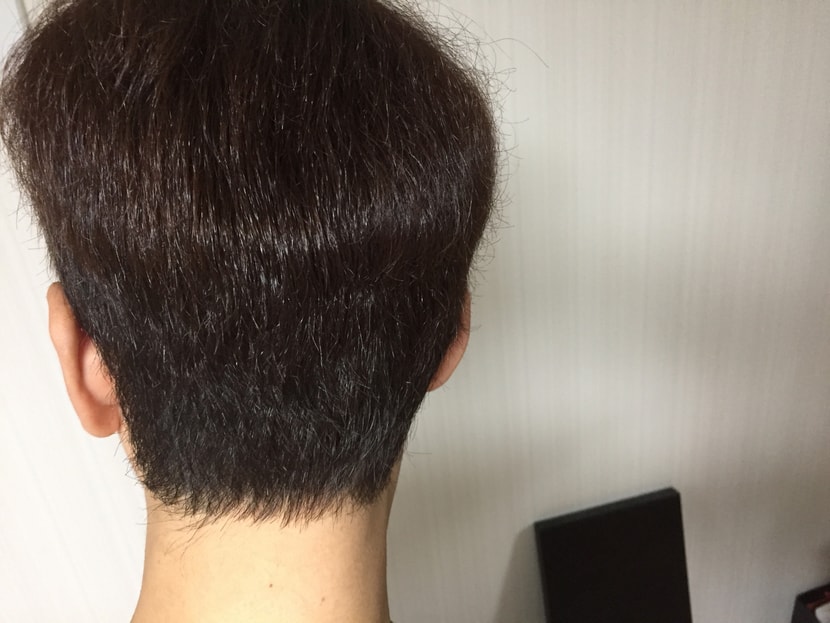 2차 리터치 후  이발전