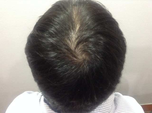 하기전 정수리 찍은 사진이에요