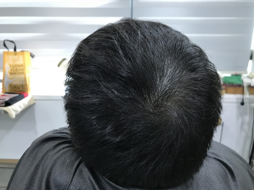 리터치 전