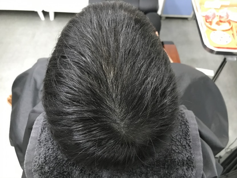 리터치 후