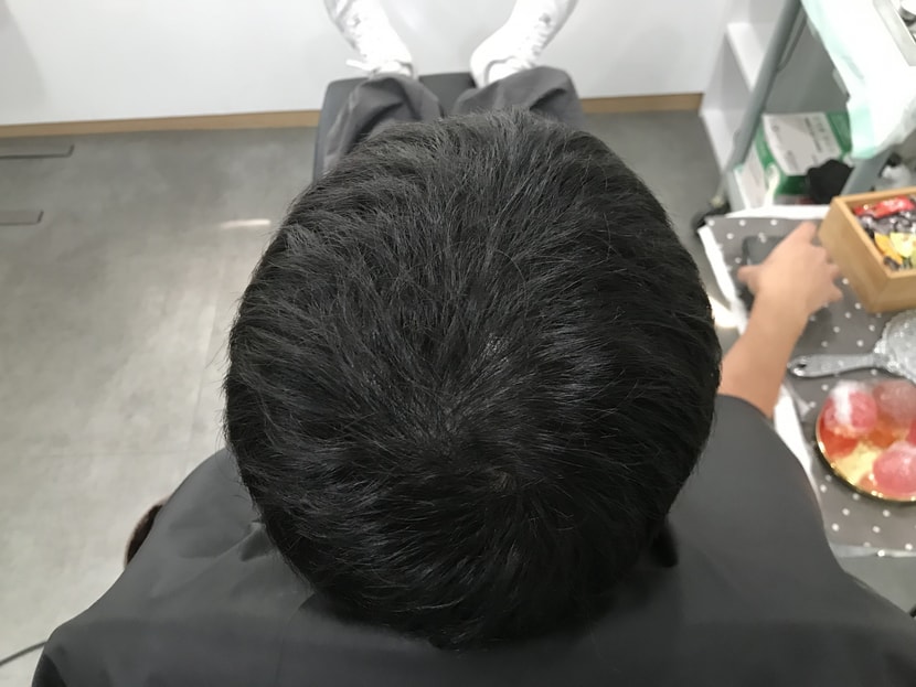 리터치 전