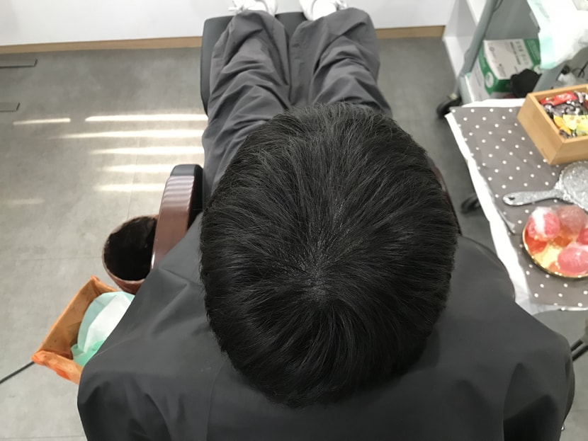 리터치 후 머리 말리고