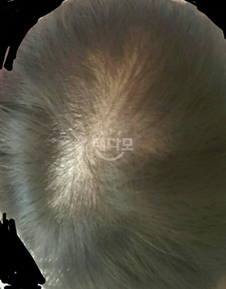 요건 시술전 사진이에요