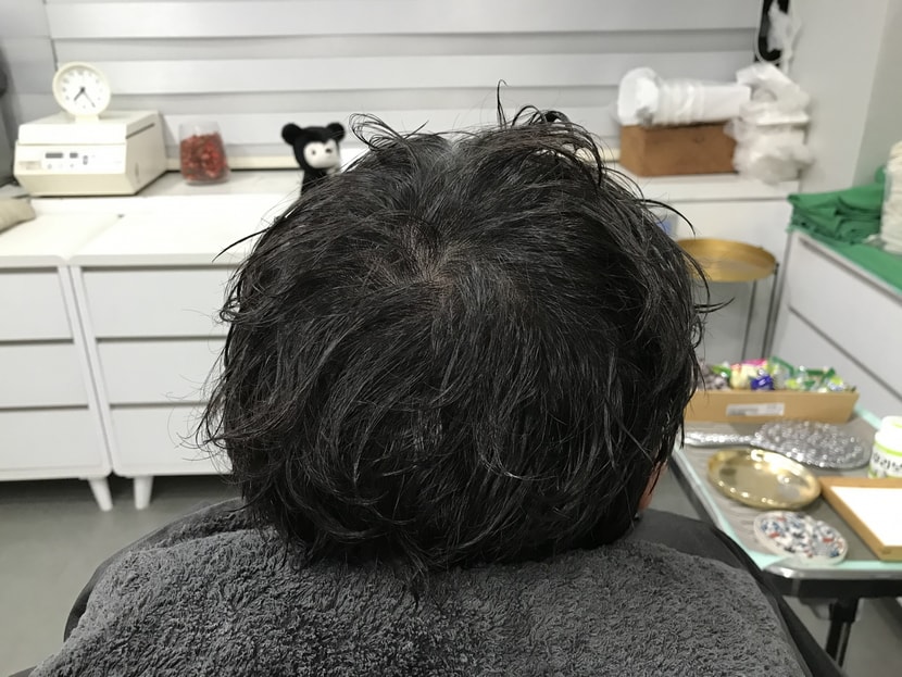 시술 후 물 젖은상태