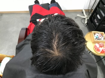 시술 전 물 젖은상태