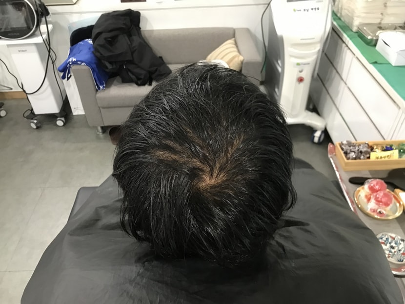 before