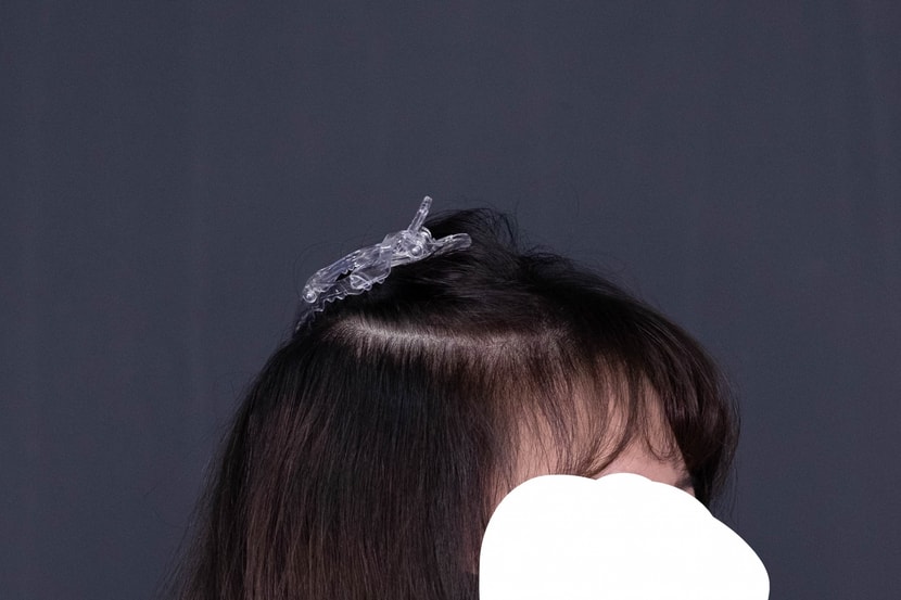후3