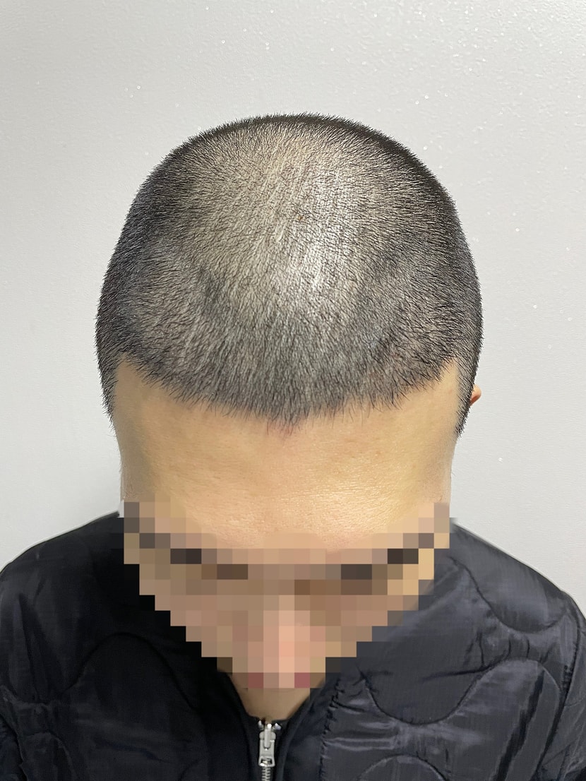 현재