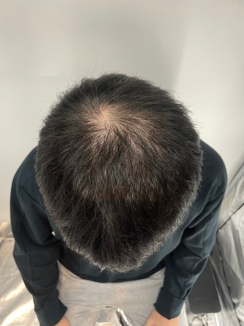 首尔新发型店头皮纹身后记