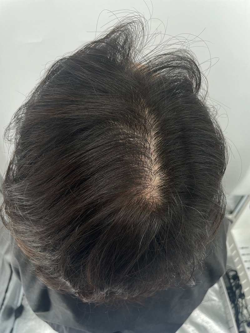 江南新发型头皮纹身第三次后记！