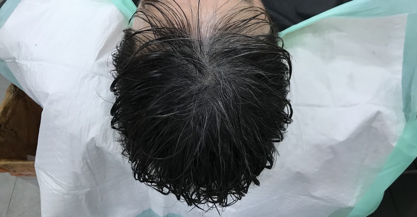 리터치 후 젖은 머리