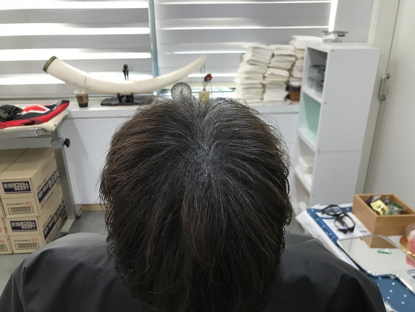 리터치 후 오히려 새치가 도드라짐