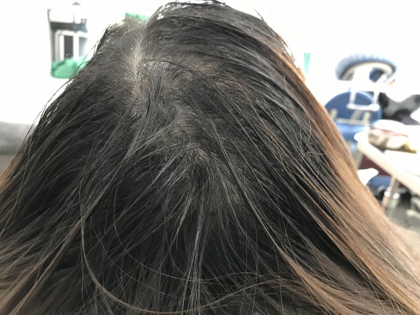 시술전 병원에서 뒤